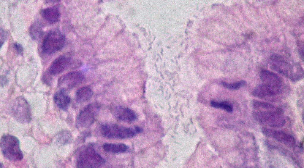 A slide showing a pink-purple stained section of stomach tissue with cells visible, with a gap at center filled with tiny curved oval bacteria.