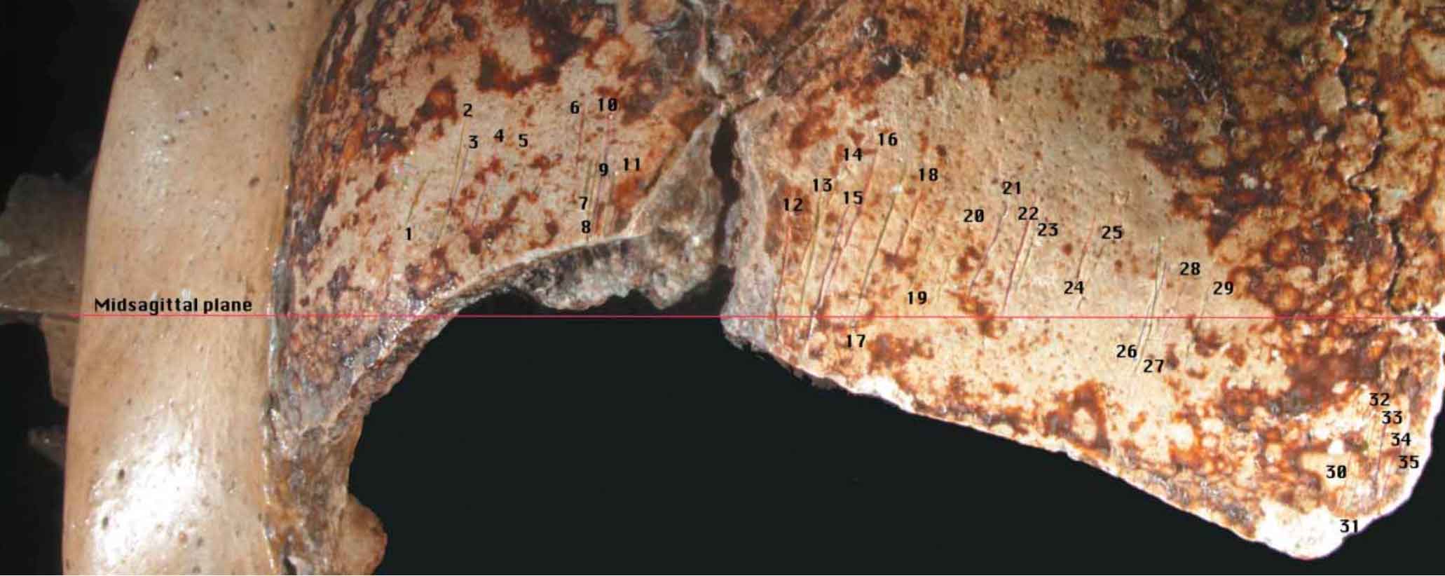 The frontal bone of Krapina 3 with cutmarks indicated by numbers and the midsagittal plane marked