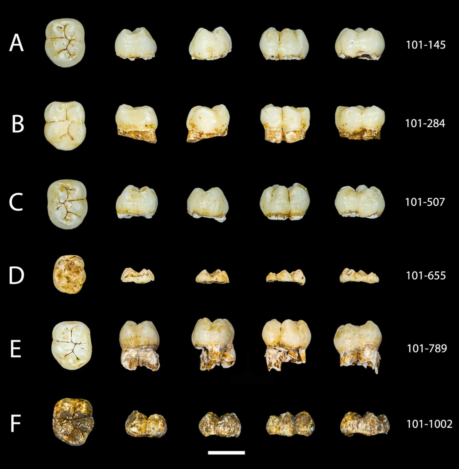 Six mandibular second molars seen in five orientations, with labels