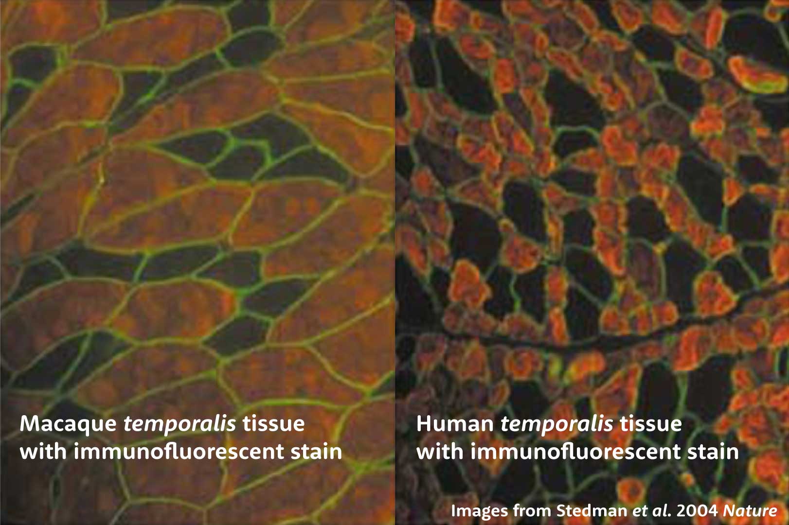 Cross sections with red stained fibers and black unstained fibers