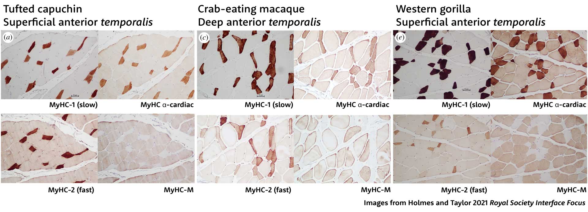 A panel of three samples of four sections of temporalis muscle tissue from three primate species, tufted capuchin, crab-eating macaque, and western gorilla. Each panel has four sections stained to detect different myosins. Described in text.