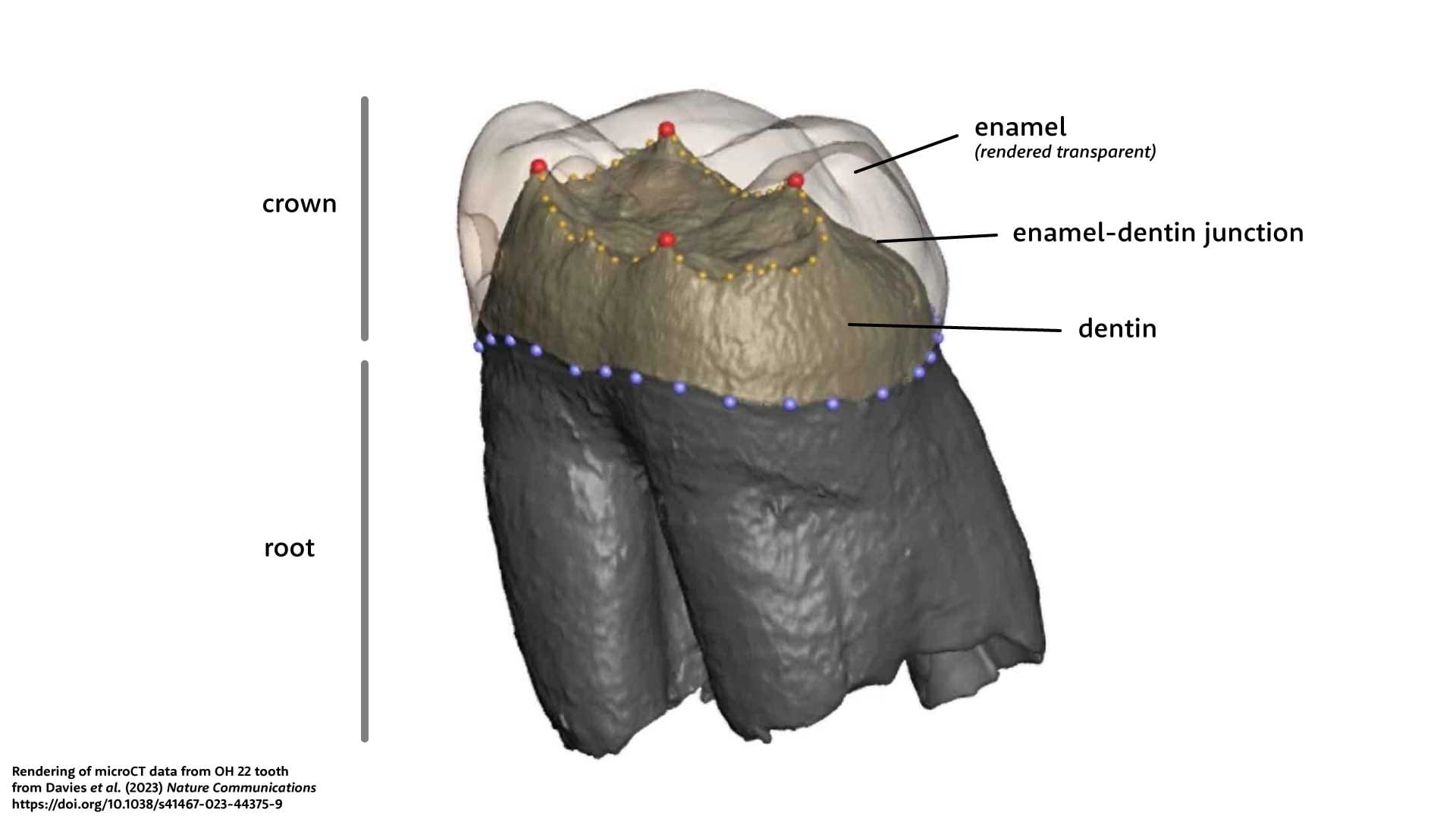Three-dimensional rendering of a tooth showing the enamel crown with transparency to make the internal dentin visible, and the enamel-dentin junction labeled.