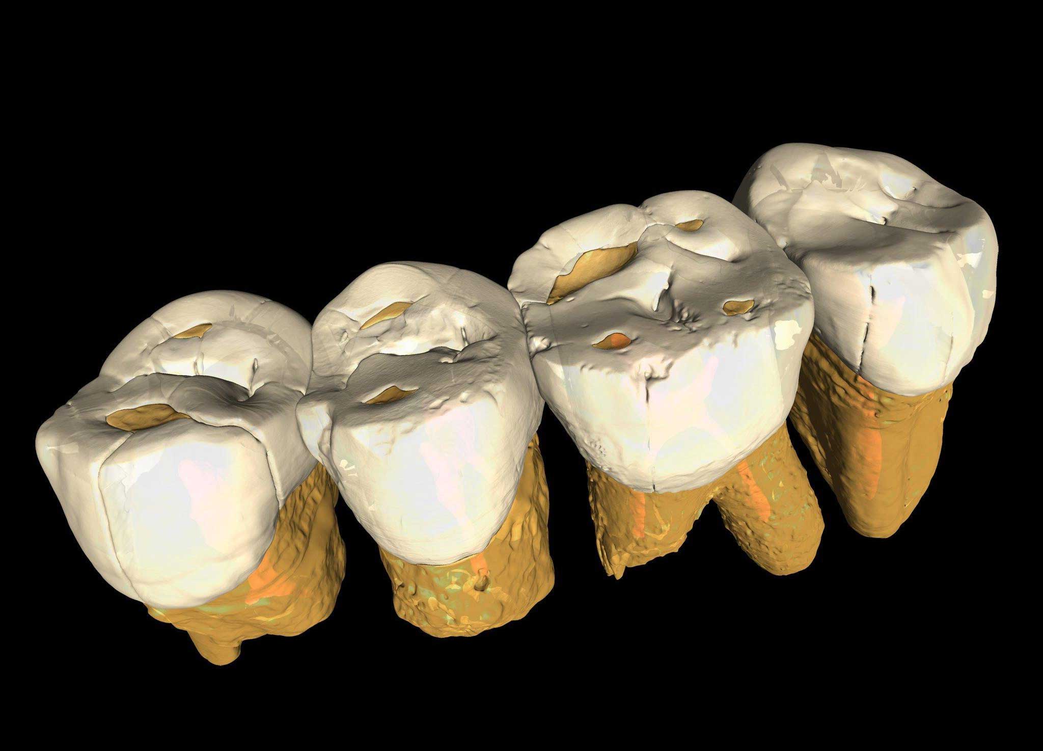 Four teeth from maxillary P3 to maxillary M2 in occlusal order shown by microCT rendering