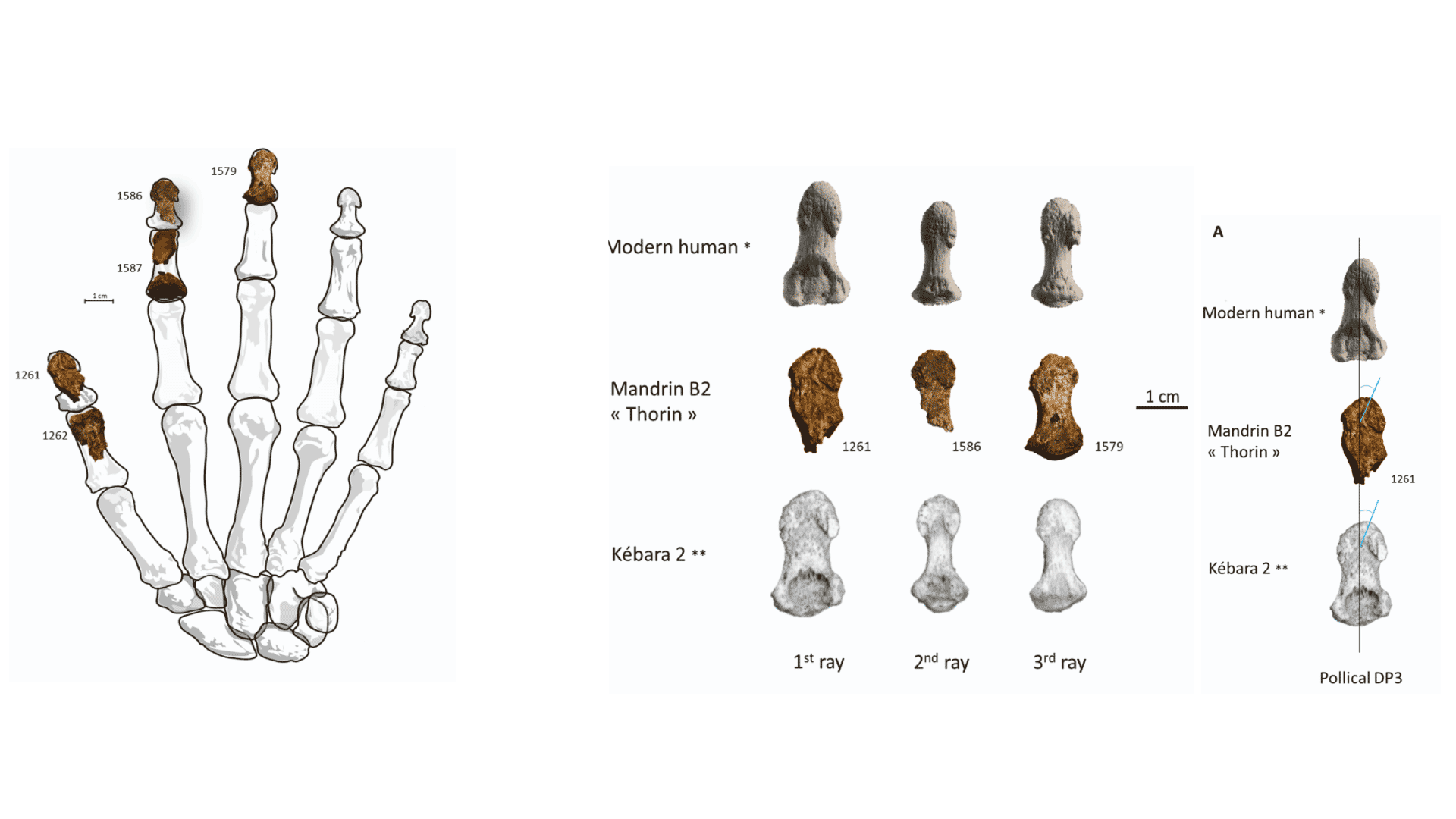 Parts of four finger bones shown on an outline of a modern human hand, and illustrations of the distal phalanges of the first, second, and third rays for Thorin, a modern human, and Kebara 2.