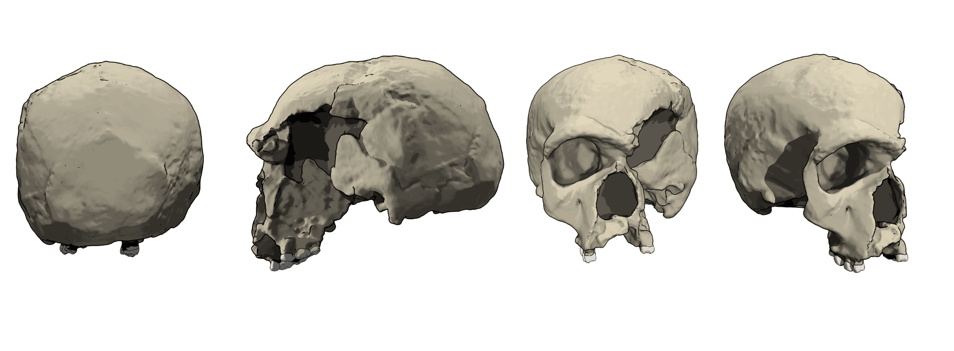 Steinheim skull illustration showing the fossil from posterior, left lateral, frontal, and right three-quarter views