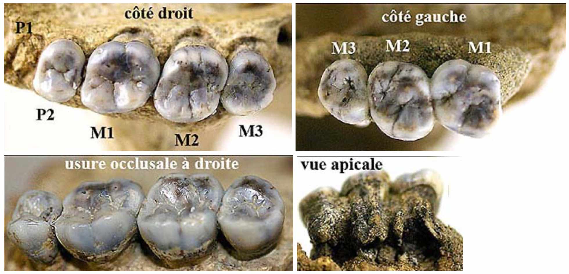 Four panels showing teeth of the Steinheim skull. Right teeth including P4 (labeled P2), M1, M2, and M3, and left M1, M2, and M3