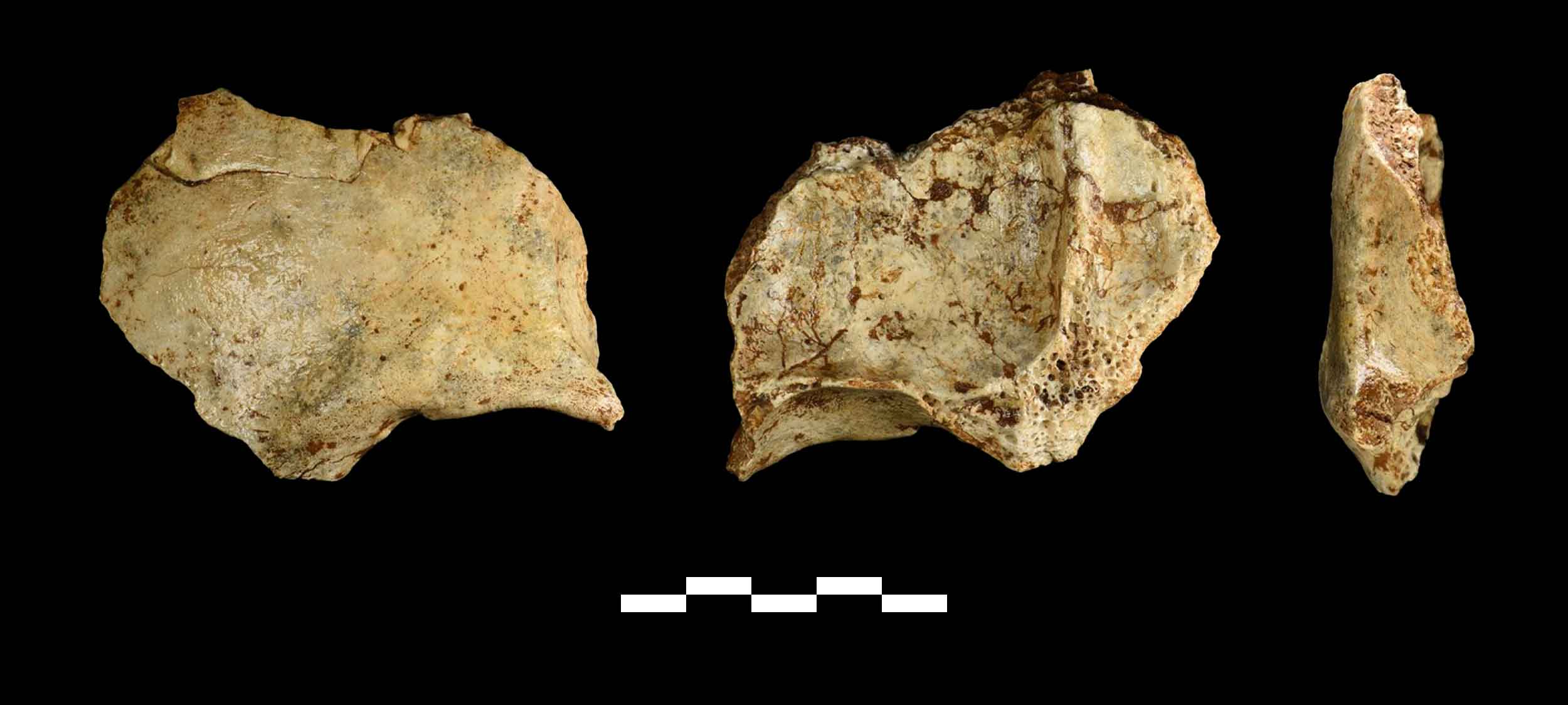 Frontal bone fragment in anterior, posterior, and lateral view showing lack of prominent browridge