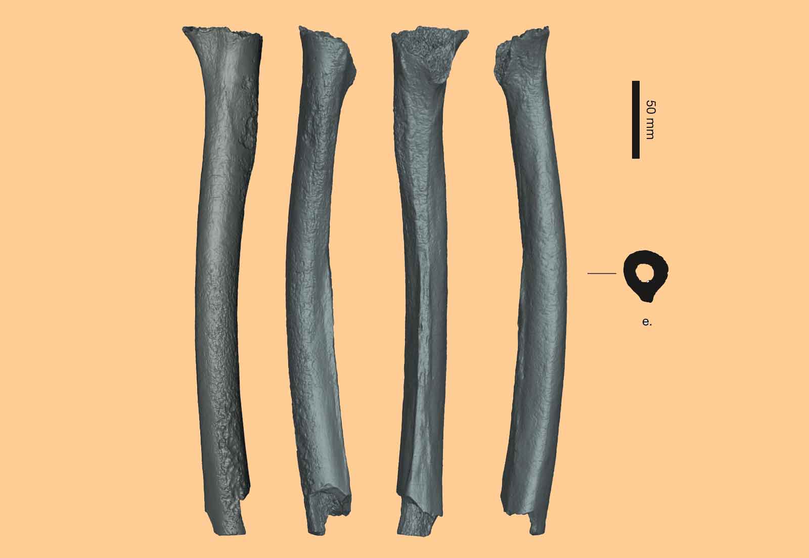 Four views of a CT rendering of a partial femur, with cross-section and scale