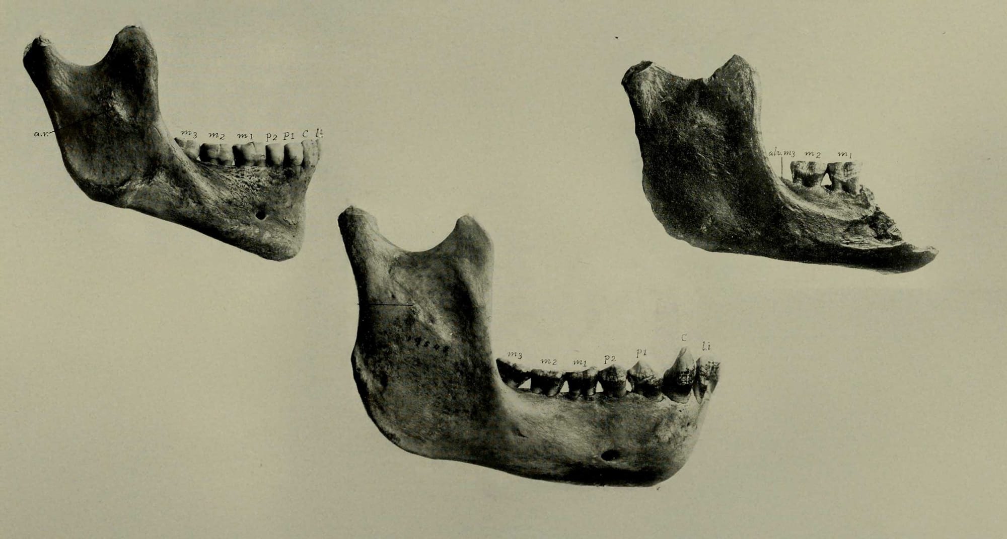 Black and white image of three jaws seen from the side, a human, orangutan, and Piltdown broken jawbone