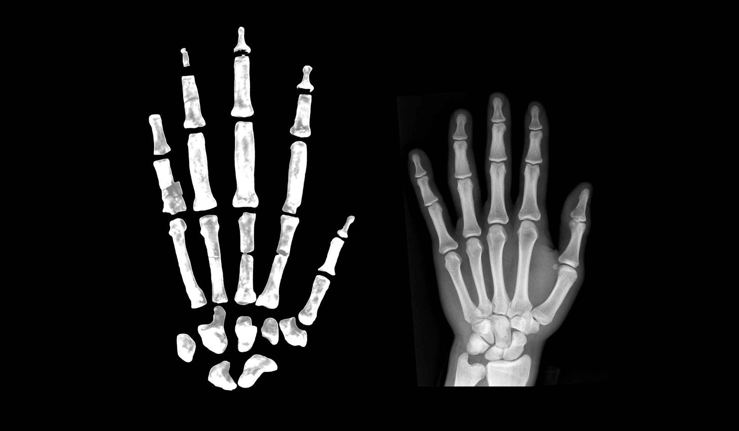 [Image: ardipithecus-hand-human-x-ray-hand-composite-1.jpg]